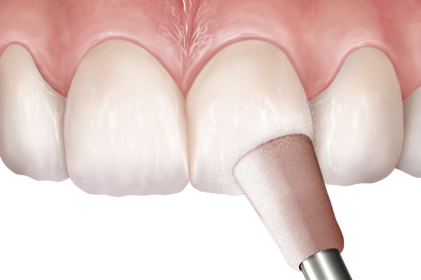 Jazz Supreme Cup – pink